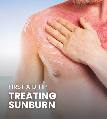 First Aid Tip: How to Treat Sunburn